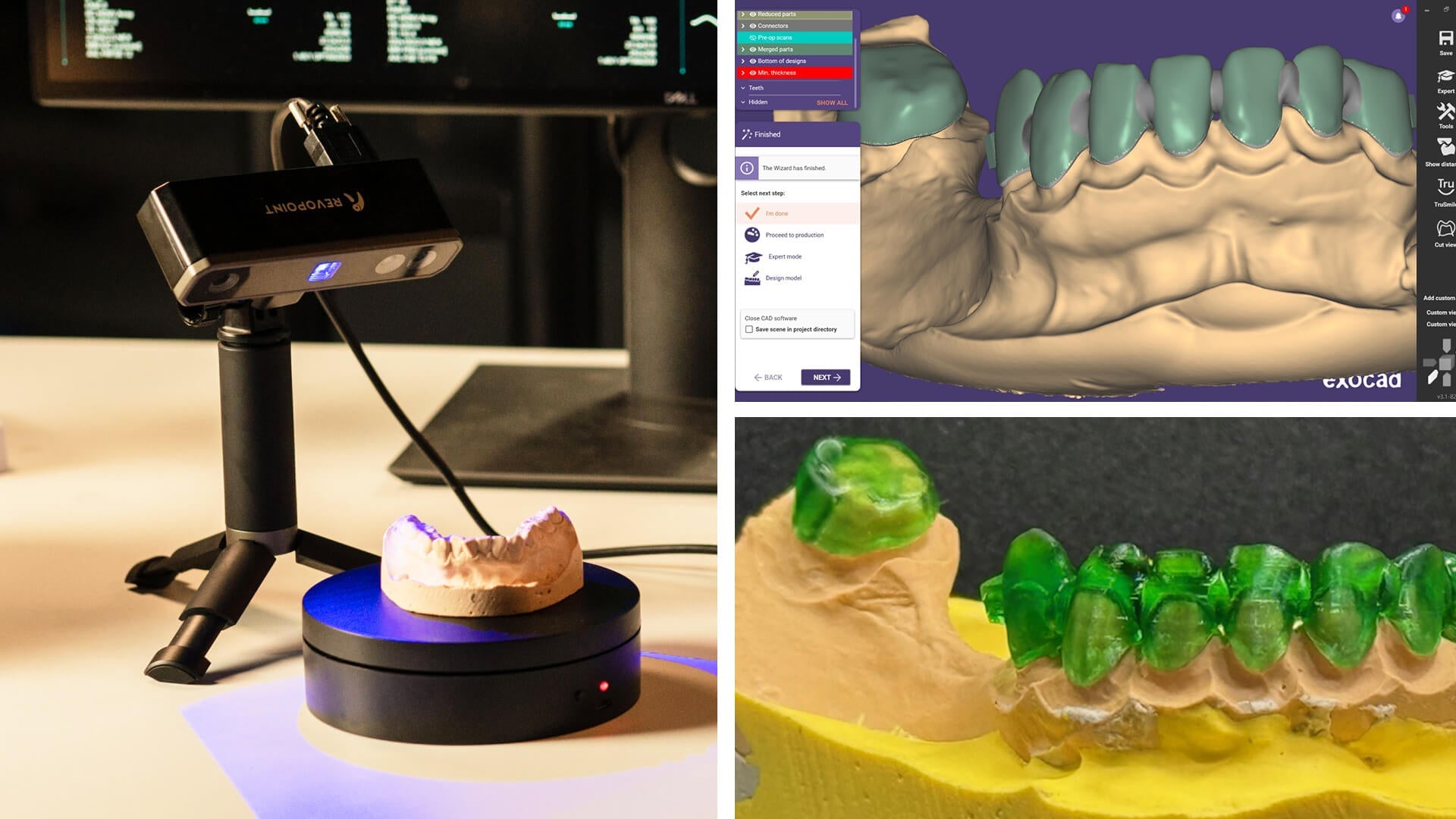 Scan. Design. Print. Cast: The Digital Dental Workflow